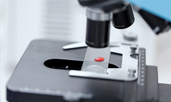 Анализ крови на железо