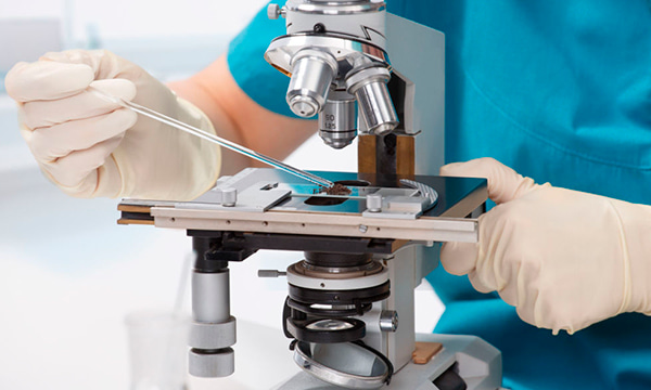 Анализ соскоба с кожи на клещей (Sarcoptes (Acarus) scabiei (чесоточный клещ))