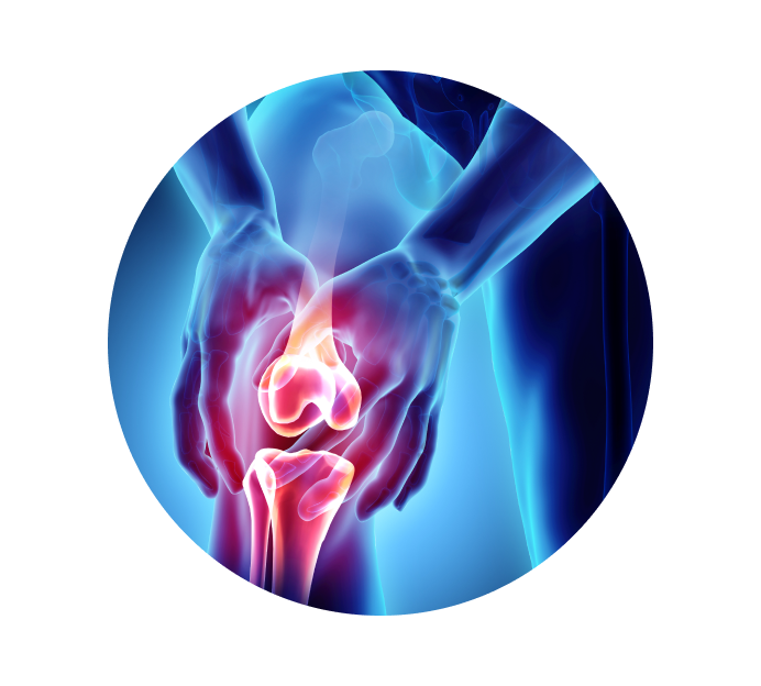 Рентген коленного сустава Рентген коленного сустава