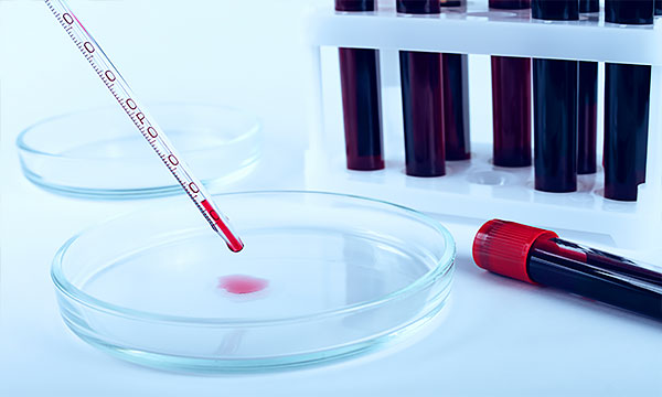 Генетическое исследование на наследственный рак Генетическое исследование на наследственный рак