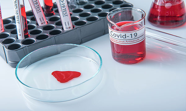 Количественный анализ на антитела класса G (IgG) к S-белку коронавируса (SARS-CoV-2) в крови (в том числе поствакцинальные)