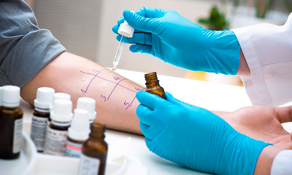 Антитела IgE к панели аллергенов FP73:F26/свинина, F27говядина, F83/куриное мясо, F88/баранина/Food Panel 73 (f26, f27, f83, f88) Антитела IgE к панели аллергенов FP73:F26/свинина, F27говядина, F83/куриное мясо, F88/баранина/Food Panel 73 (f26, f27, f83, f88)