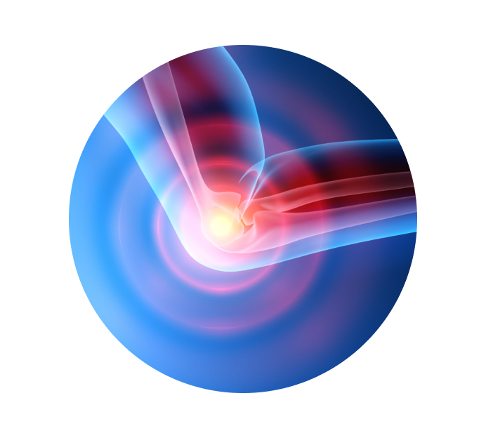 Рентген локтевого сустава Рентген локтевого сустава