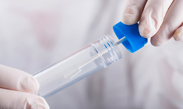 Анализ кала на стеркобилин