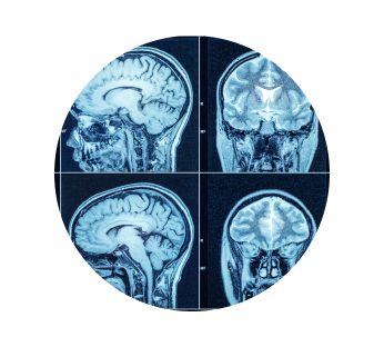 Рентген головы