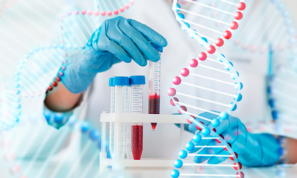 Анализ крови на антитела к лямблиям классов A, M, G (IgM, IgA, IgG) Анализ крови на антитела к лямблиям классов A, M, G (IgM, IgA, IgG)