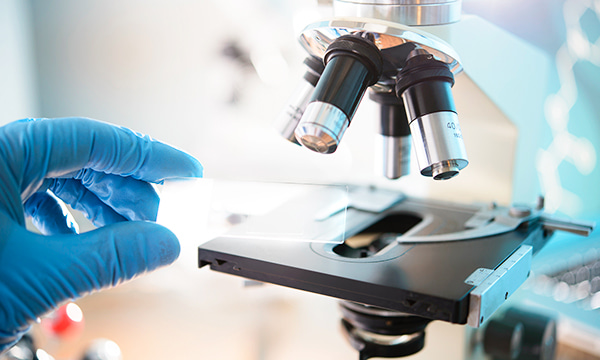 Цитологическое исследование пунктата щитовидной железы с пункцией Цитологическое исследование пунктата щитовидной железы с пункцией