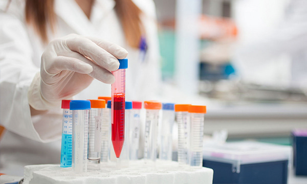 Исследование уровня С4 фракции комплемента в крови