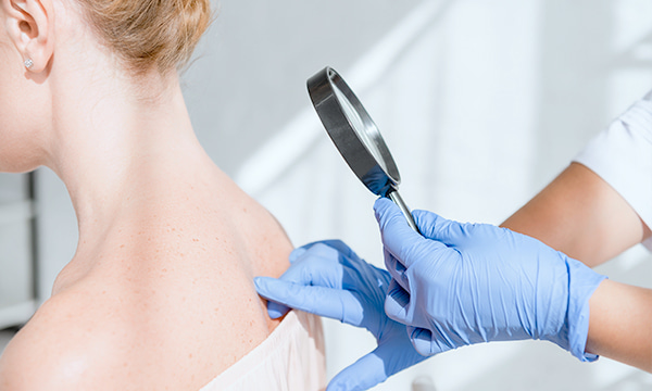 Люминесцентная диагностика (осмотр под лампой Вуда) Люминесцентная диагностика (осмотр под лампой Вуда)