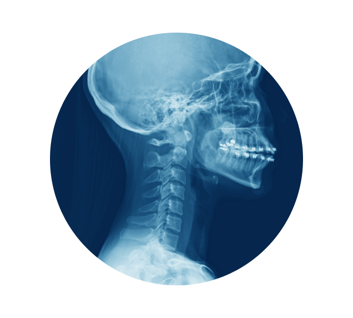 Рентген шейного отдела позвоночника Рентген шейного отдела позвоночника