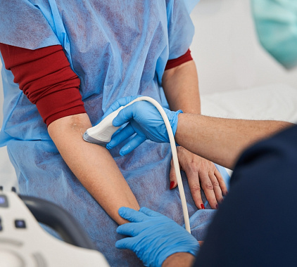 УЗИ вен верхней конечности