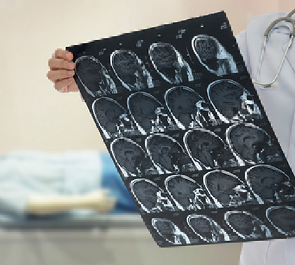 Рентген головы