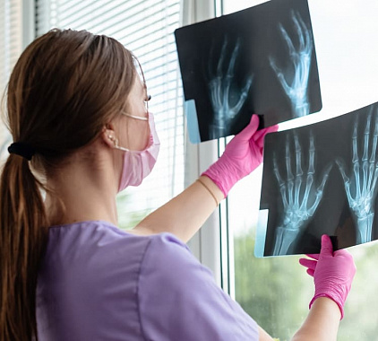 Рентгенография Рентгенография