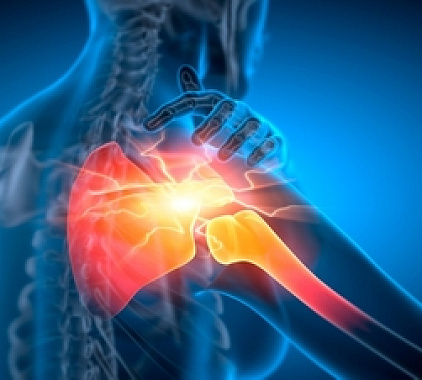 Рентген суставов