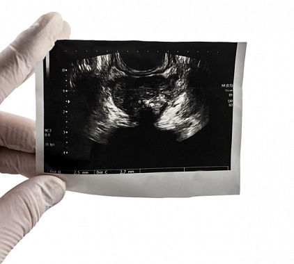 ТРУЗИ ТРУЗИ