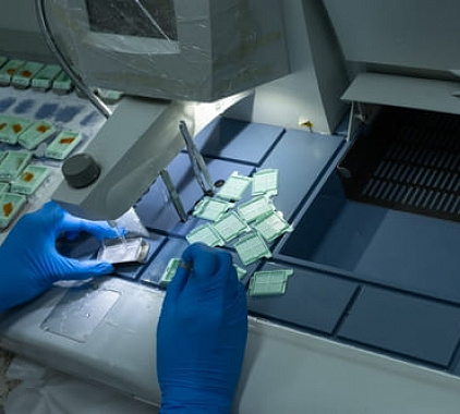 Биопсия Биопсия