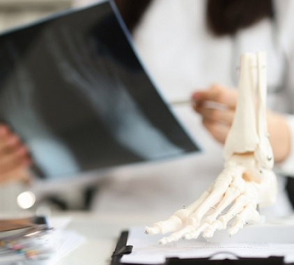 Рентген голеностопного сустава Рентген голеностопного сустава