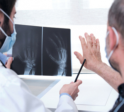 Рентген суставов