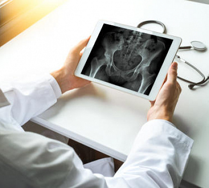 Рентген ТБС Рентген ТБС