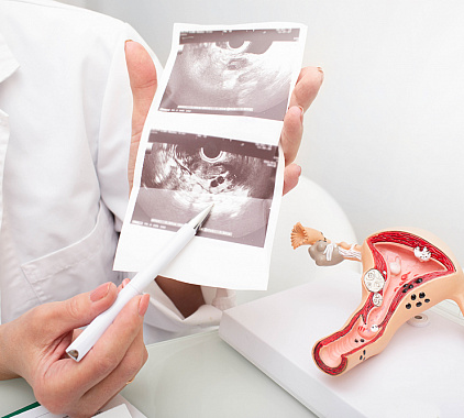 УЗИ яичников