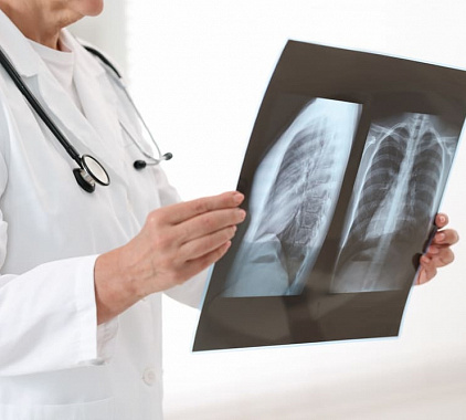 Рентгенография Рентгенография