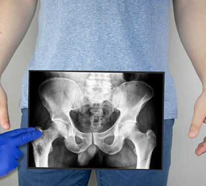 Рентген ТБС Рентген ТБС