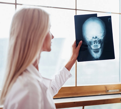 Рентген головы