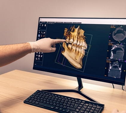 Рентген зуба