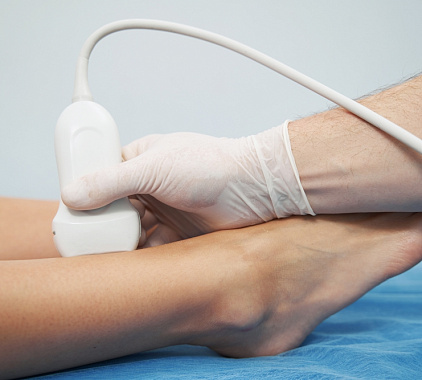 УЗИ вен нижней конечности