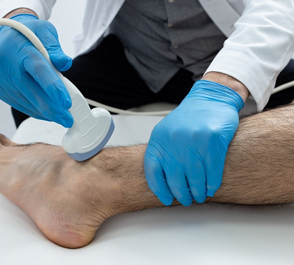 УЗИ голеностопного сустава 1 УЗИ голеностопного сустава 1