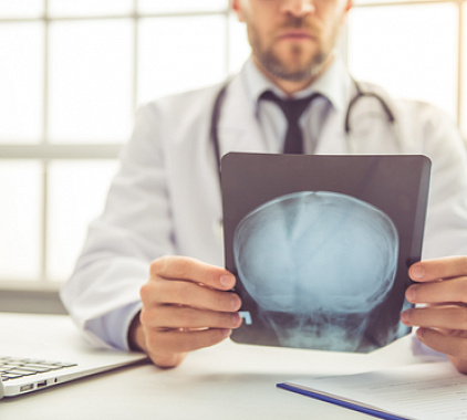 Рентген пазух носа Рентген пазух носа