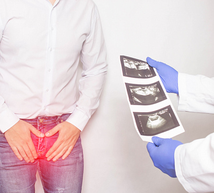 УЗИ предстательной железы УЗИ предстательной железы