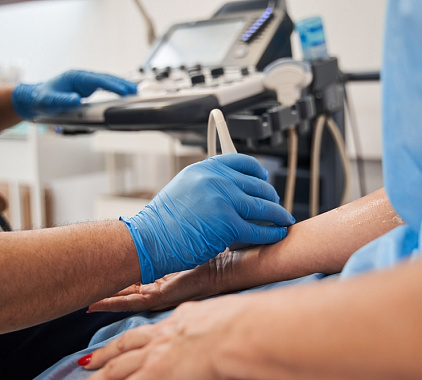 УЗИ артерий руки