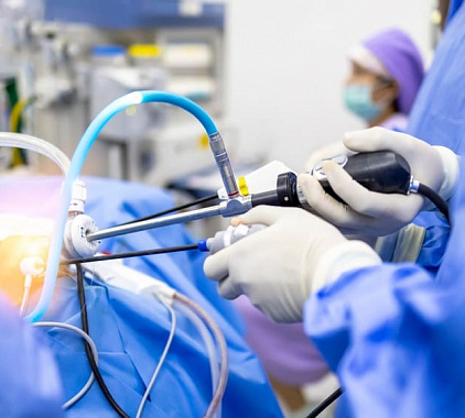 Эндоскопия