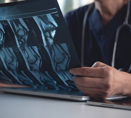 Рентген коленного сустава Рентген коленного сустава